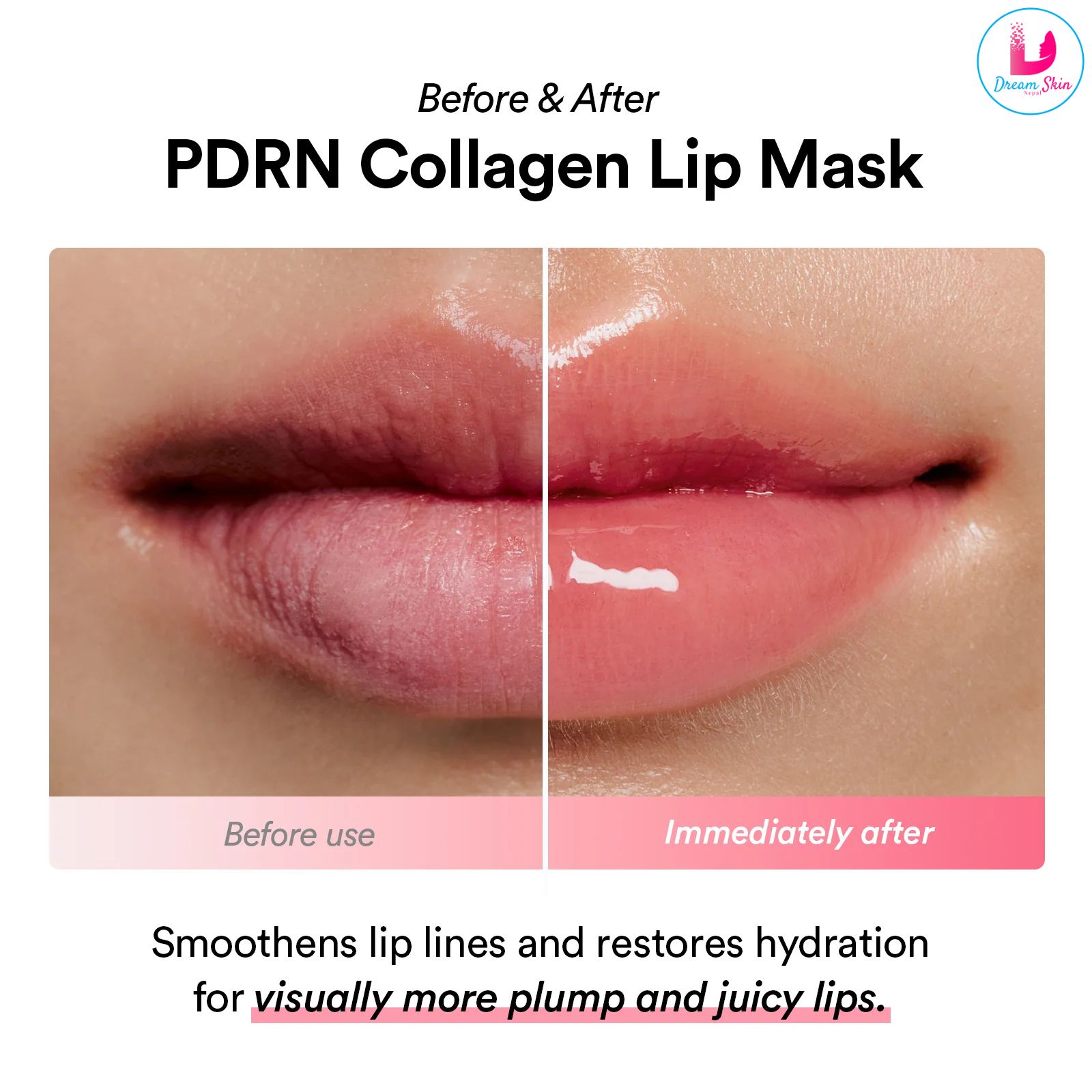 Abib PDRN Collagen Lip Mask Glazed Jelly [11g]	